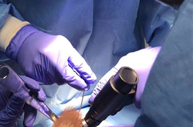 Fonctions et applications des scies orthopédiques